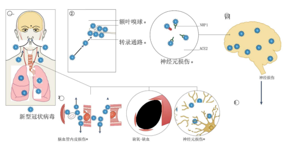 新冠病毒超强破坏力：长时间滞留体内，渗透多种器官；康复后仍可死灰复燃，攻击中枢神经