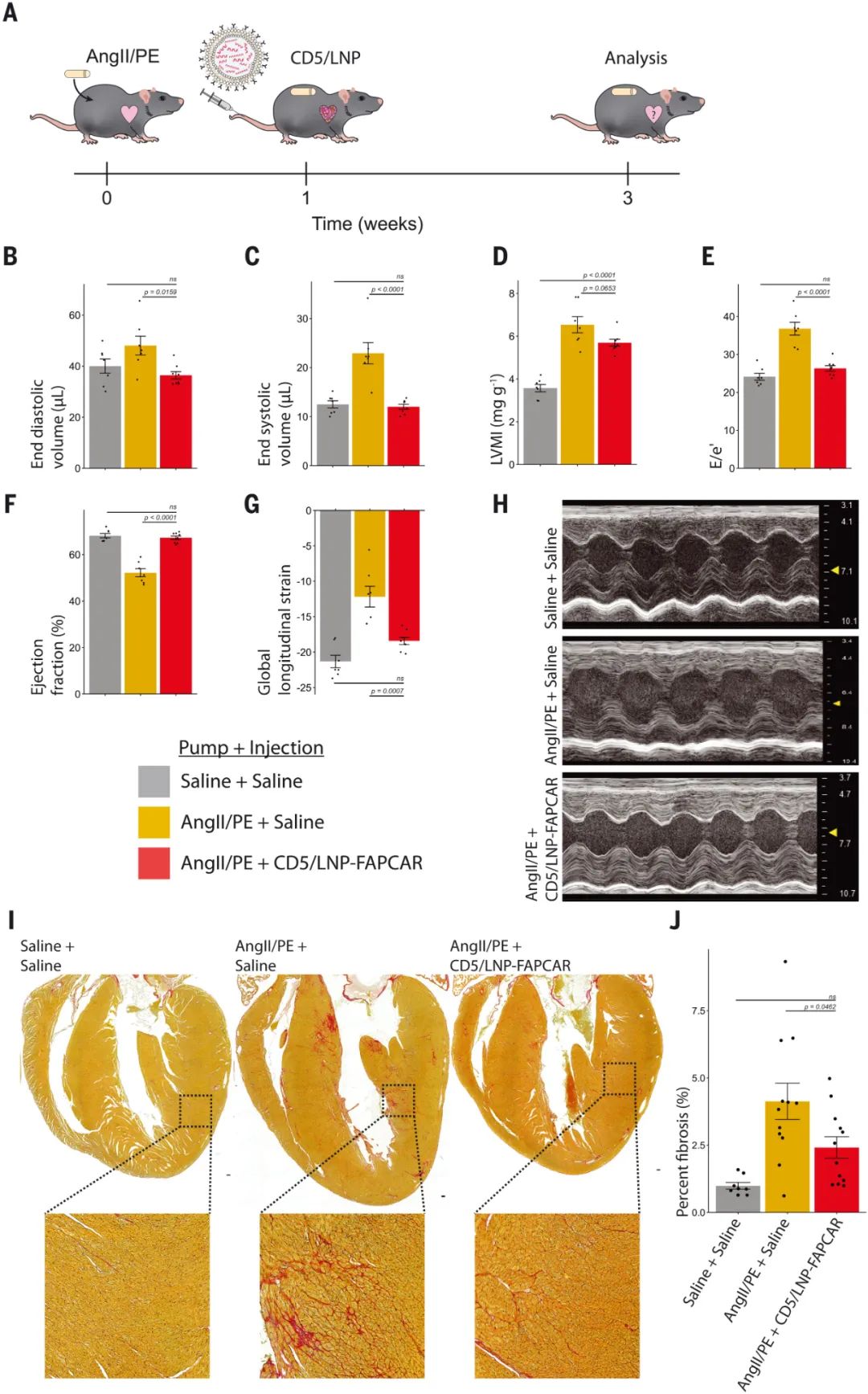 Science重磅：注射mRNA，直接在体内生成CAR-T，一针修复心脏