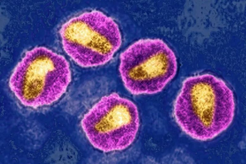 Science重磅：一种更严重、传播更快的HIV突变株已出现