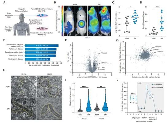 Cancer Discov：震惊！转移性黑色素瘤利用「β淀粉样蛋白」破坏大脑免疫防御