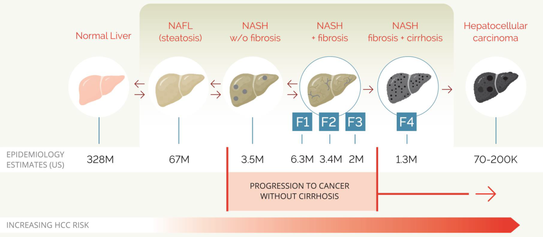 NASH新进展：Galectin 报告Belapectin 在NASH所致肝硬化患者中的2b/3 期试验取得积极成果