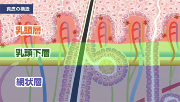 水性凝胶贴片的机理与国外临床试验