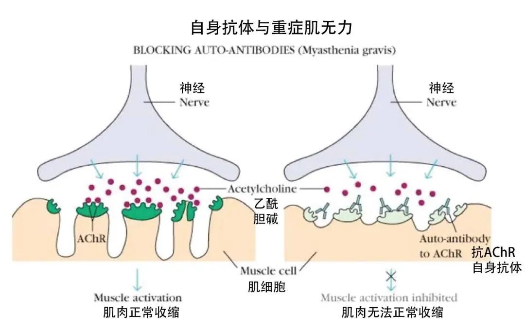 每年29亿美元年销售额？一文解析治疗重症肌无力的新药efgartigimod