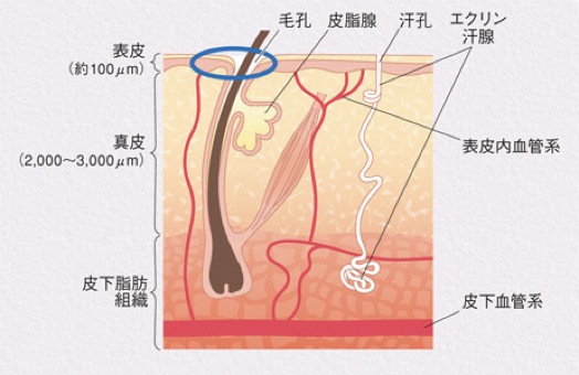 水性凝胶贴片的机理与国外临床试验