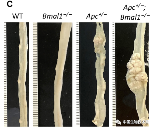 Science子刊：科学家首次揭示生物钟紊乱与结直肠癌之间的机制联系