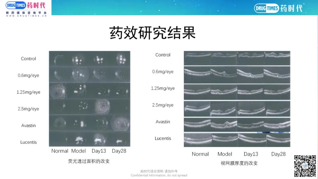 药时代BD-038项目 | VEGF靶向单抗III期眼病蓝海项目