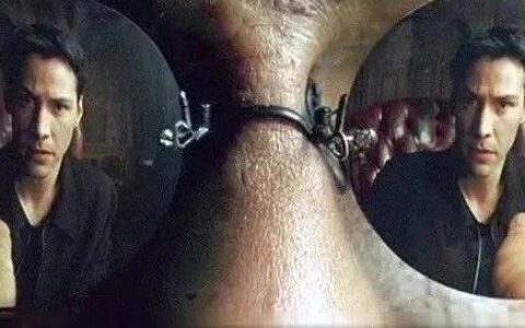 一款被「逼」出来的F-I-C药物：靶向两个降血压靶点，却获批了「降蛋白尿」适应症…