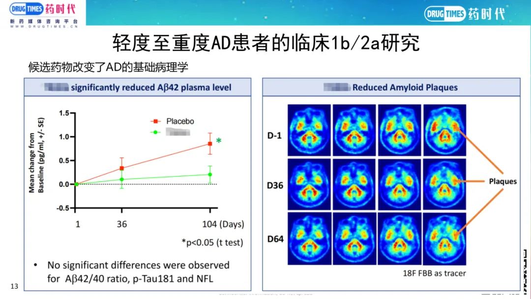 药时代BD-056项目 | 美国临床阶段生物公司寻找投资及AD项目合作