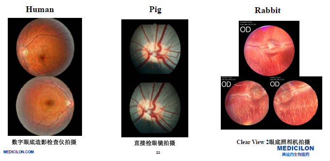 手持秘密武器，撬动百亿美元市场！