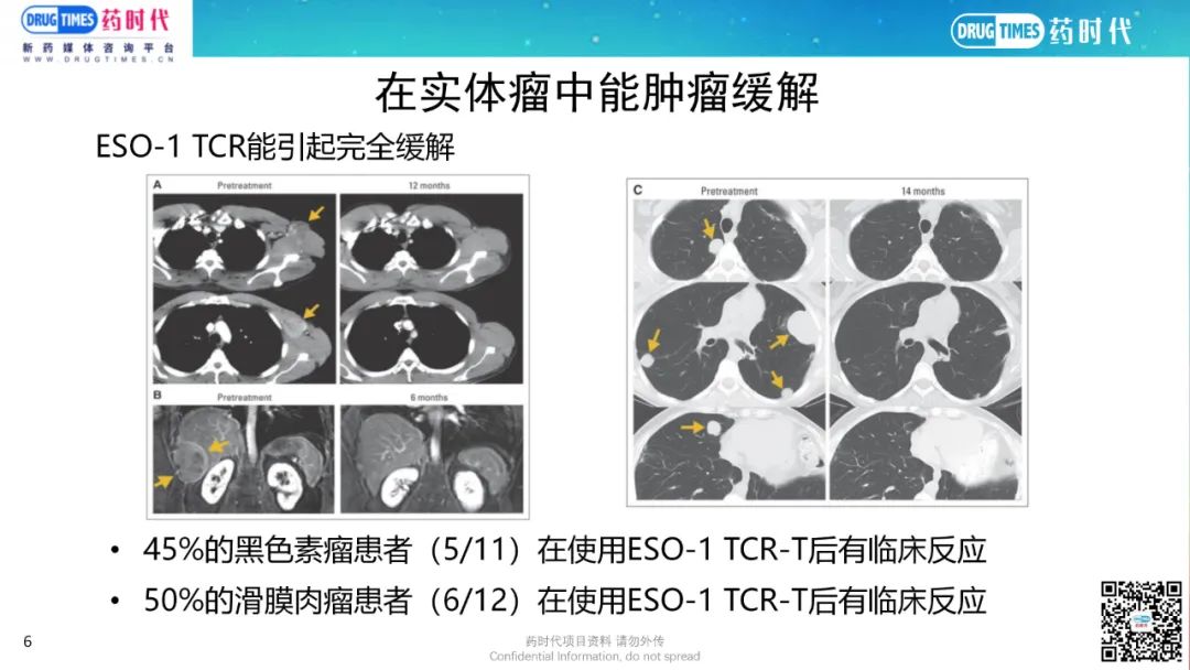 药时代BD-063项目 | NY-ESO-1靶点安全、有效TCR-T项目寻求合作