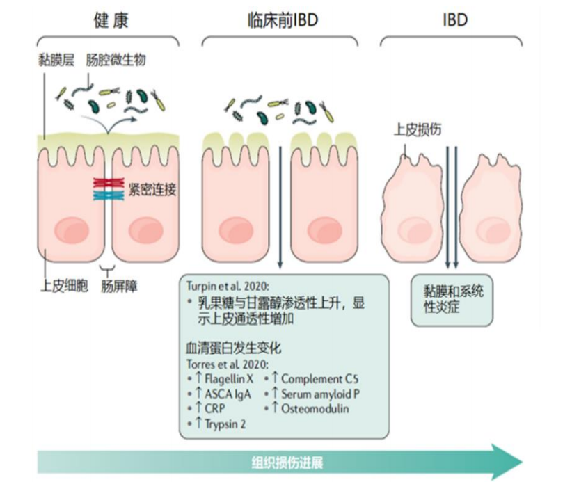 【产品出售】通过局部作用治疗炎症性肠病的FIC小分子创新药寻求合作