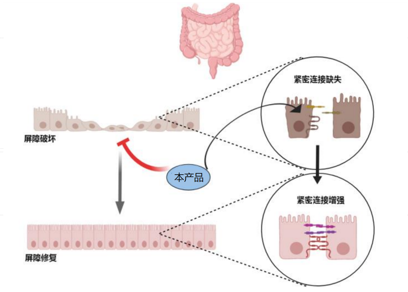 【产品出售】通过局部作用治疗炎症性肠病的FIC小分子创新药寻求合作