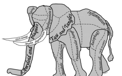 The development of new drugs for Alzheimer's disease needs to adopt a holistic approach