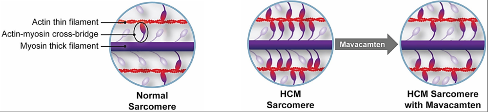 HCM