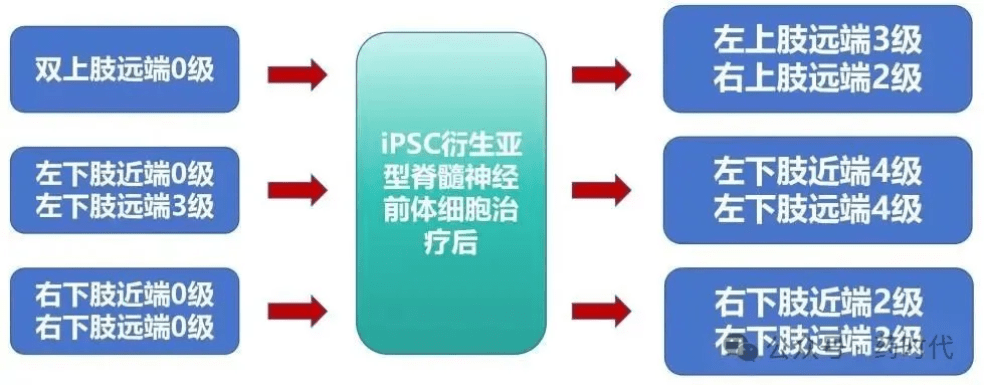 iPSC
